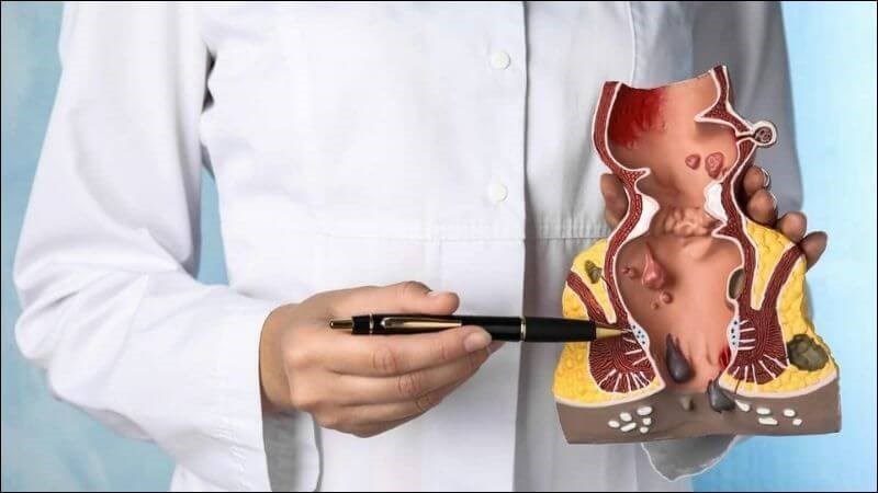 Benh Tri 1 800x450 1